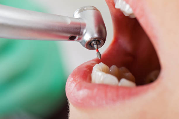 Best Emergency Treatment for Dental Infections or Abscesses in Mulino, OR